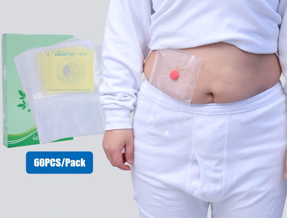 Disposable Colostomy Bags: A Necessity Or A Waste Of Money?
